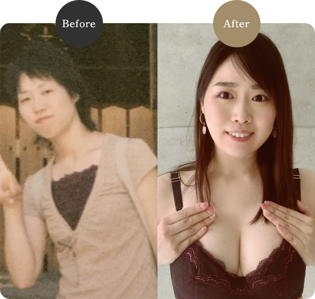 before after